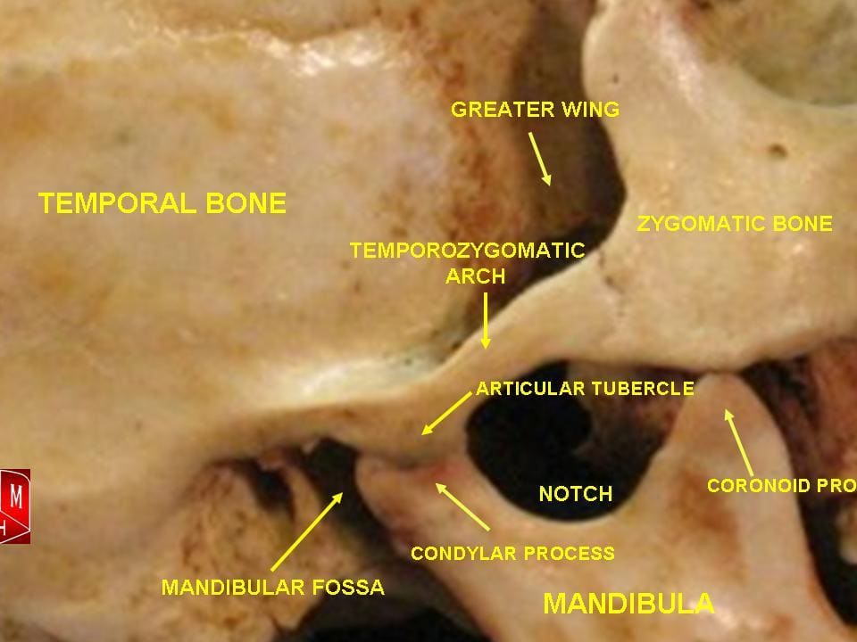 TMJ (Temporomandibular joint) Syndrome